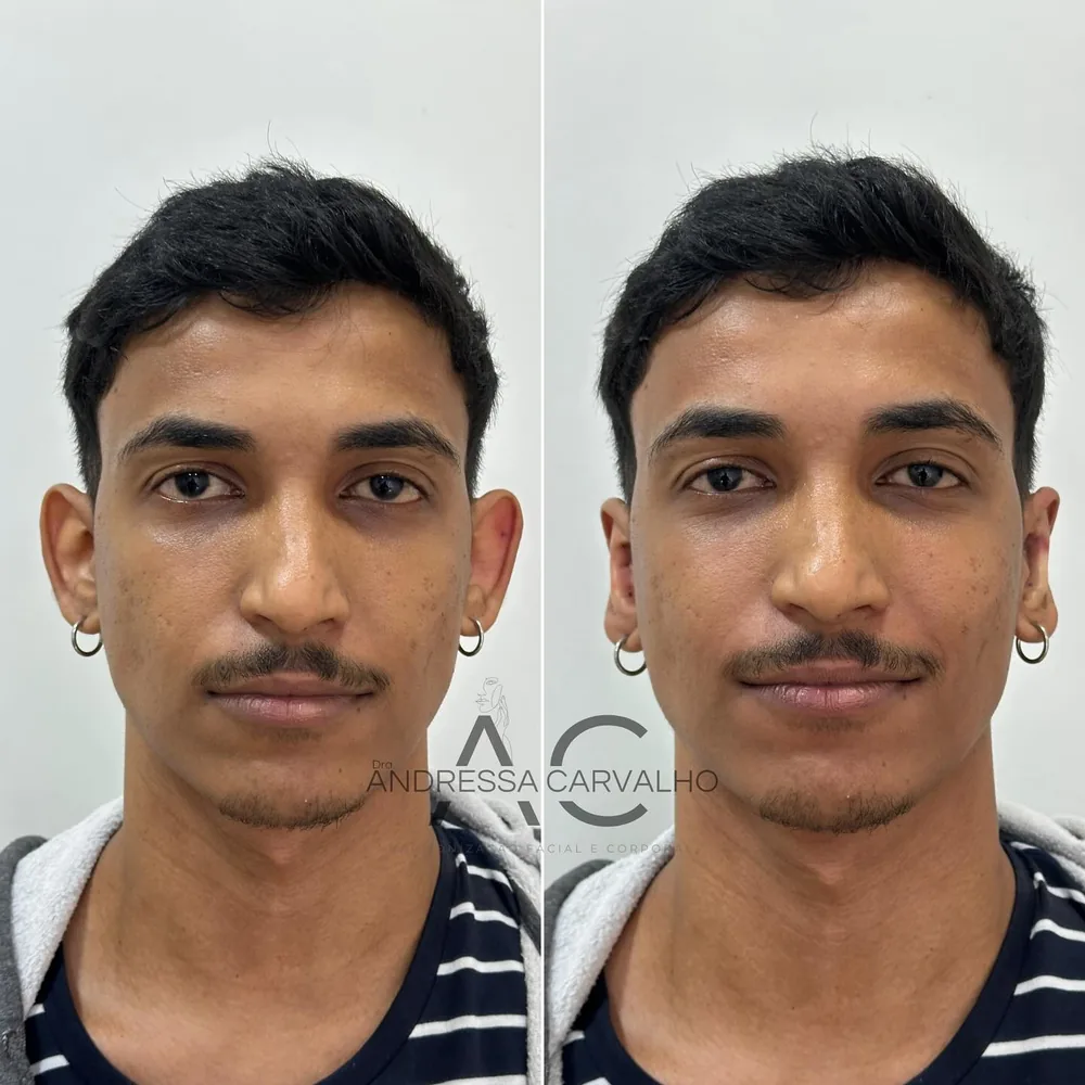 Comparativo de resultado de paciente
