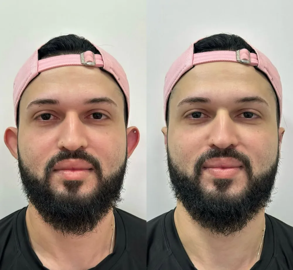 Comparativo de resultado de paciente