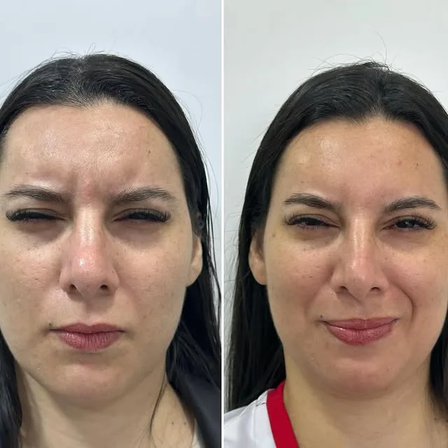 Comparativo de resultado de paciente