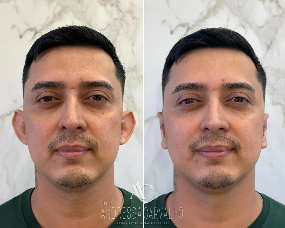 Comparativo de resultado de paciente