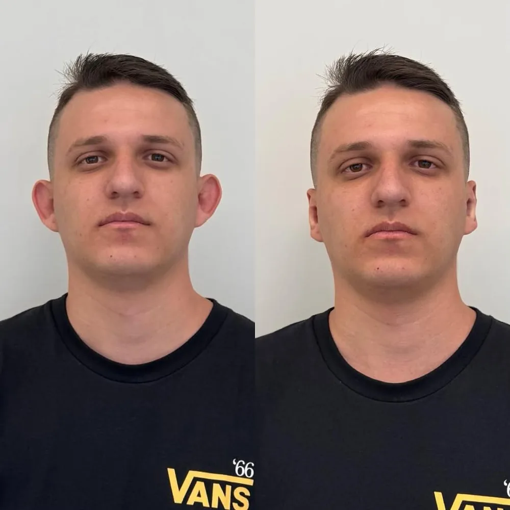 Comparativo de resultado de paciente
